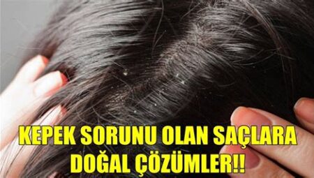 Saç Derisinde Kepek Sorununu Giderme Yöntemleri